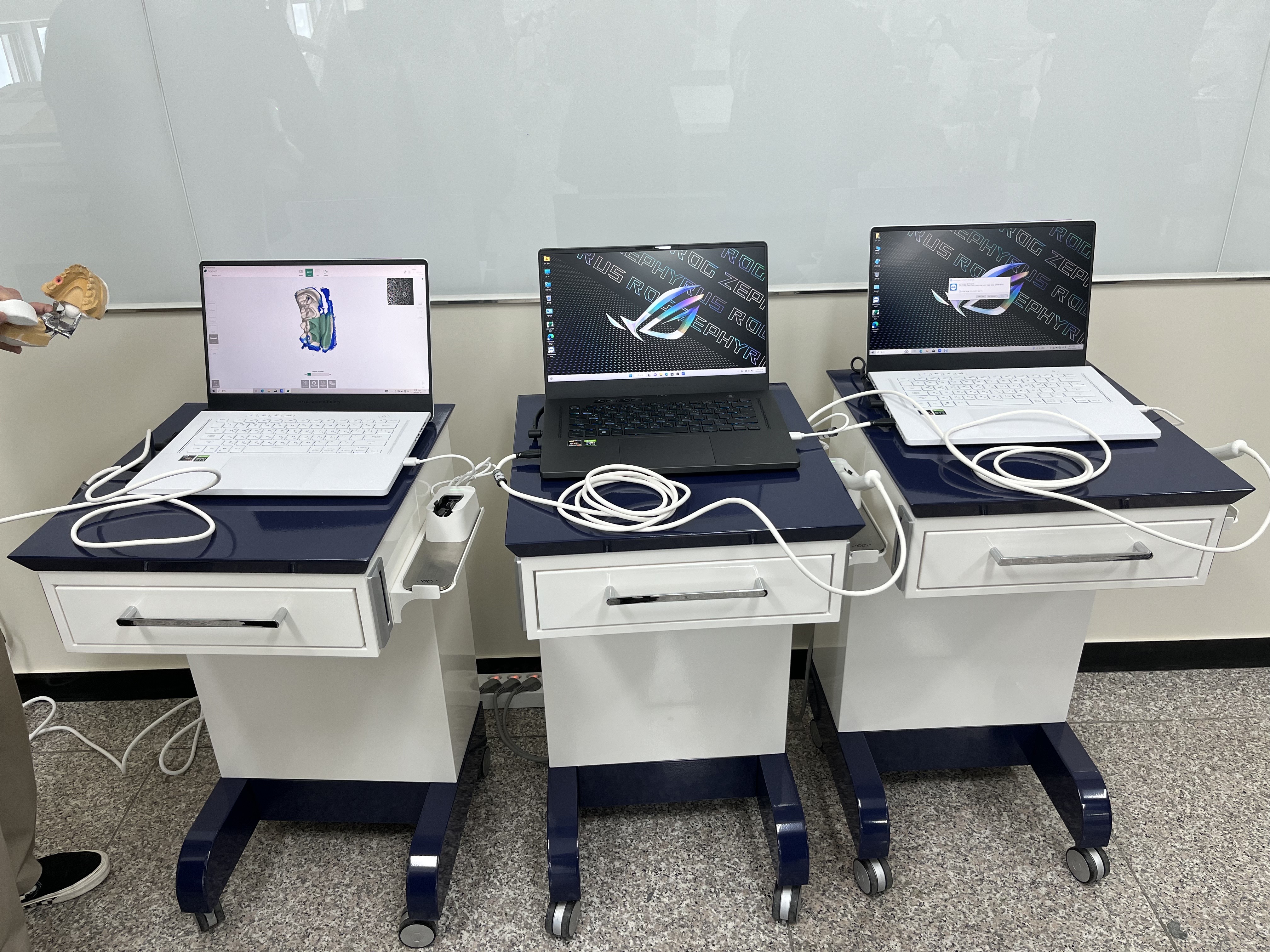 구강스캐너